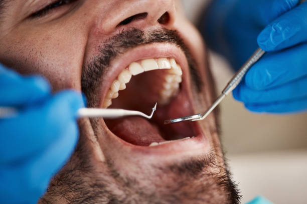 Best Mobile Emergency Dentist in Moundsville, WV